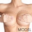 breast-augmentation